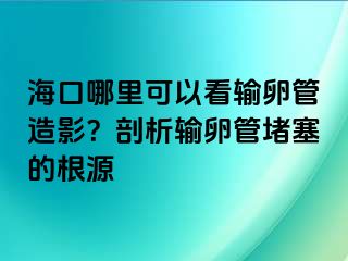 海口哪里可以看输卵管造影？剖析输卵管堵塞的根源