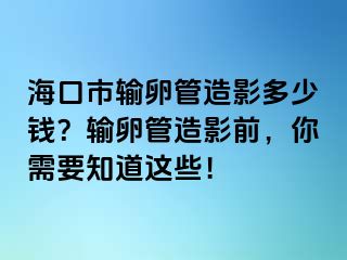 海口市输卵管造影多少钱？输卵管造影前，你需要知道这些！