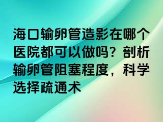 海口输卵管造影在哪个医院都可以做吗？剖析输卵管阻塞程度，科学选择疏通术