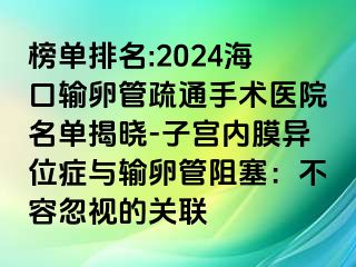 榜单排名:2024海口输卵管疏通手术医院名单揭晓-子宫内膜异位症与输卵管阻塞：不容忽视的关联